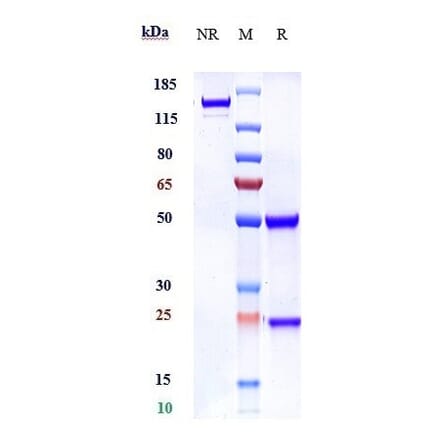 SDS-PAGE - Anti-Robo1 Antibody [Research Grade Biosimilar] - Low endotoxin, Azide free (A324208) - Antibodies.com