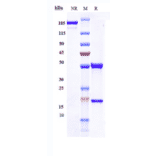 SDS-PAGE - Anti-RON Antibody [H5B14] - Low endotoxin, Azide free (A324210) - Antibodies.com
