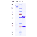 SDS-PAGE - Anti-SCN11A Antibody [Research Grade Biosimilar] - Low endotoxin, Azide free (A324233) - Antibodies.com