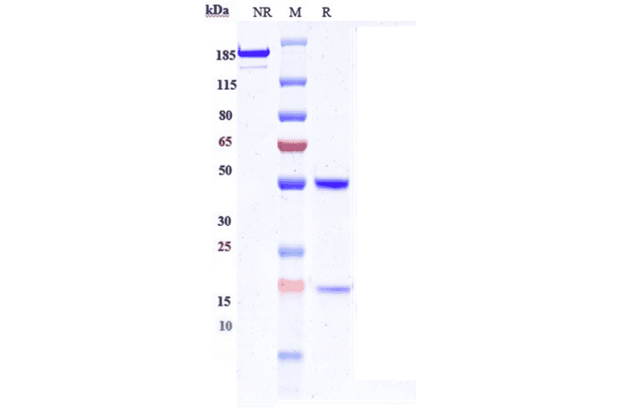 SDS-PAGE - Anti-Sez6 Antibody [Abbv-011] - Low endotoxin, Azide free (A324235) - Antibodies.com
