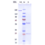 SDS-PAGE - Anti-SIGLEC15 Antibody [Research Grade Biosimilar] - Low endotoxin, Azide free (A324237) - Antibodies.com