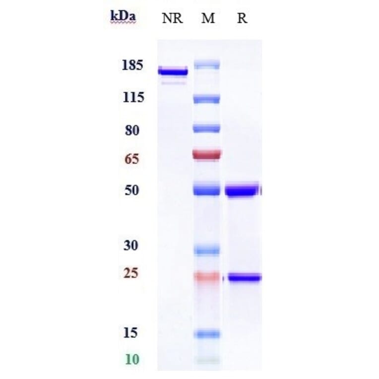 SDS-PAGE - Anti-SIGLEC15 Antibody [NC318] - Low endotoxin, Azide free (A324238) - Antibodies.com