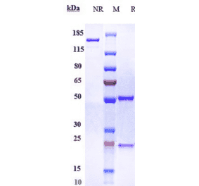 SDS-PAGE - Anti-SIGLEC15 Antibody [AB-25E9] - Low endotoxin, Azide free (A324239) - Antibodies.com
