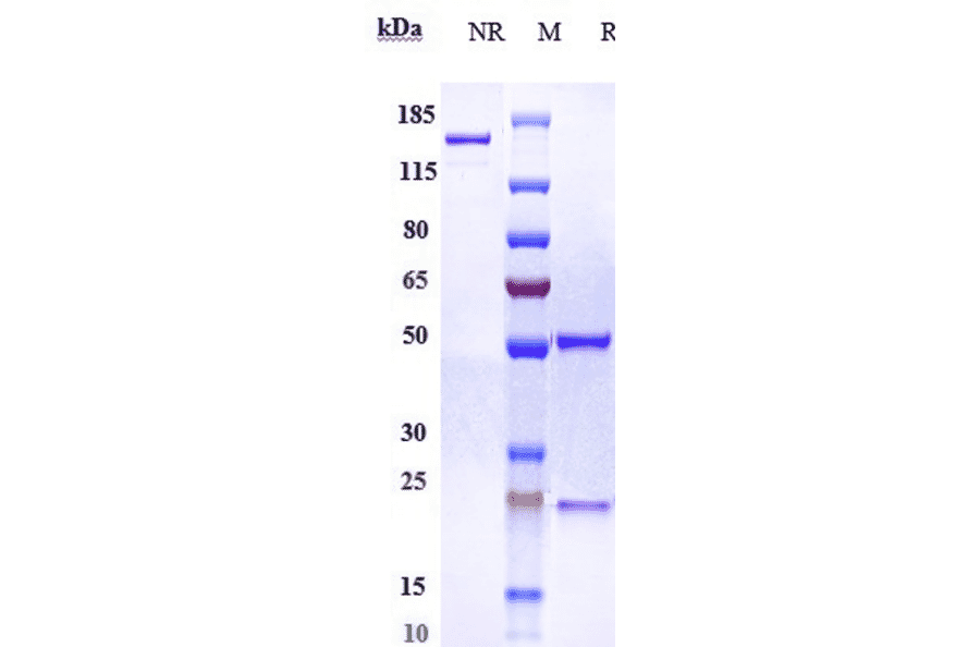 SDS-PAGE - Anti-SIGLEC15 Antibody [AB-25E9] - Low endotoxin, Azide free (A324239) - Antibodies.com