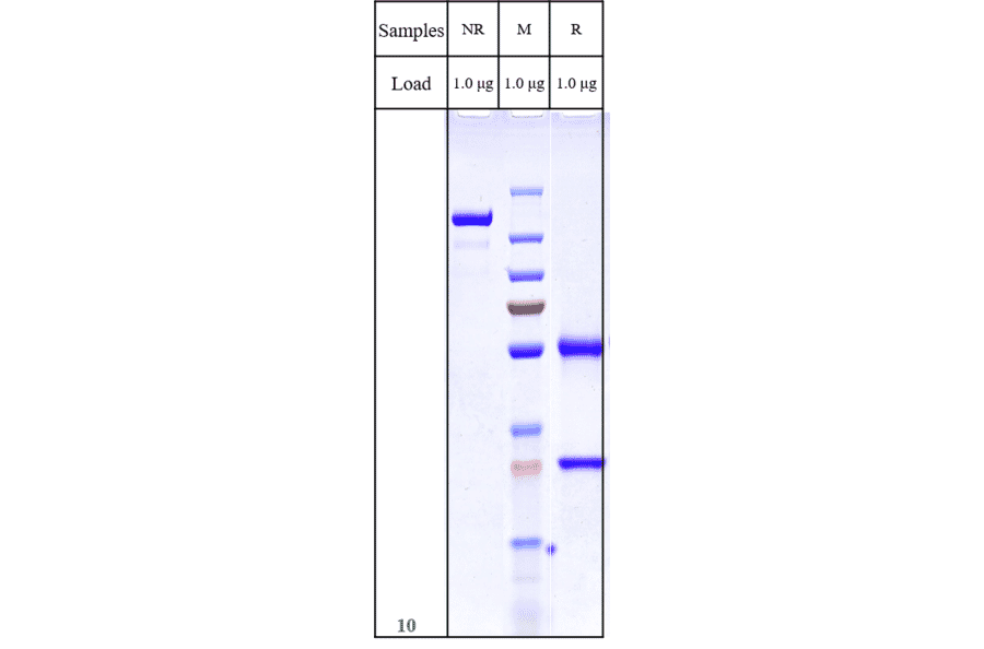 SDS-PAGE - Anti-SLC39A6/ZIP-6 Antibody [Research Grade Biosimilar] - Low endotoxin, Azide free (A324244) - Antibodies.com