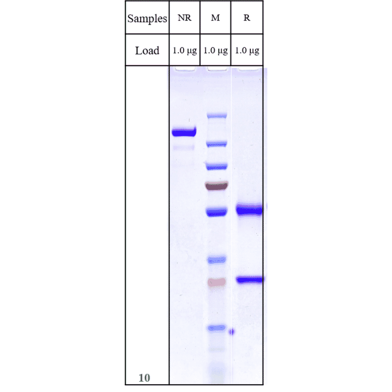 SDS-PAGE - Anti-SLC39A6/ZIP-6 Antibody [Research Grade Biosimilar] - Low endotoxin, Azide free (A324244) - Antibodies.com
