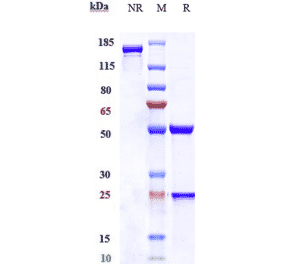 SDS-PAGE - Anti-SLC40A1 Antibody [Research Grade Biosimilar] - Low endotoxin, Azide free (A324245) - Antibodies.com