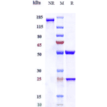 SDS-PAGE - Anti-SLC40A1 Antibody [Research Grade Biosimilar] - Low endotoxin, Azide free (A324245) - Antibodies.com