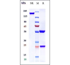 SDS-PAGE - Anti-SLC40A1 Antibody [LY2928057] - Low endotoxin, Azide free (A324246) - Antibodies.com