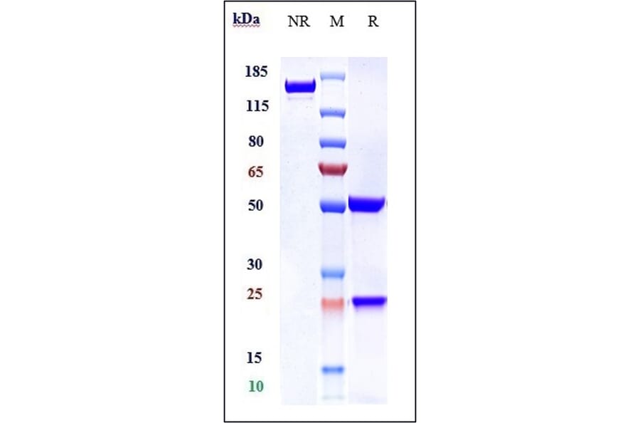 SDS-PAGE - Anti-SLC40A1 Antibody [LY2928057] - Low endotoxin, Azide free (A324246) - Antibodies.com