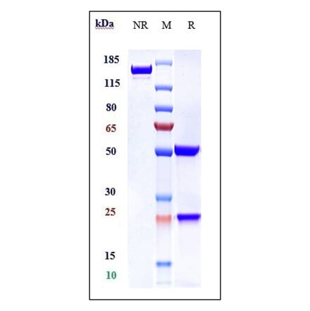 SDS-PAGE - Anti-SLC40A1 Antibody [LY2928057] - Low endotoxin, Azide free (A324246) - Antibodies.com