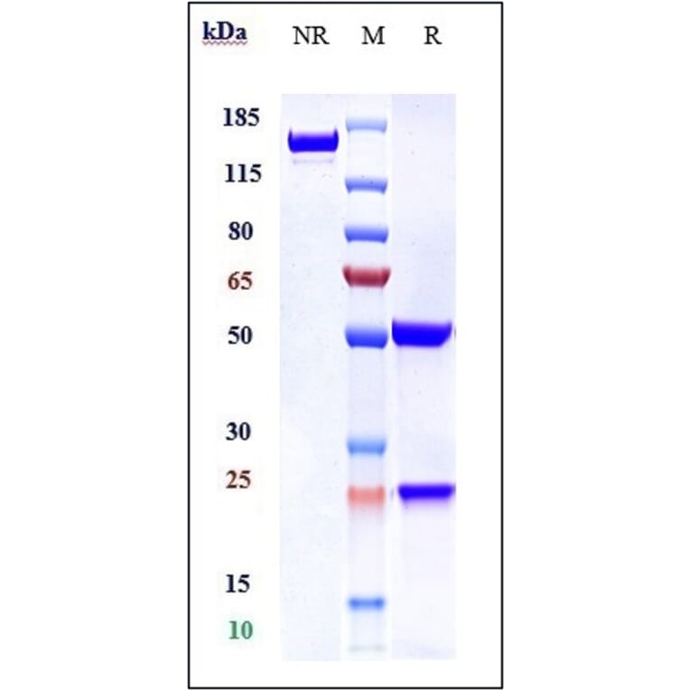 SDS-PAGE - Anti-SLC40A1 Antibody [LY2928057] - Low endotoxin, Azide free (A324246) - Antibodies.com