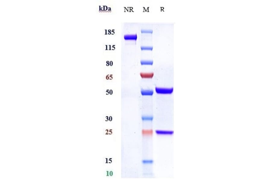 SDS-PAGE - Anti-SLC44A4 Antibody [ASG-5ME] - Low endotoxin, Azide free (A324247) - Antibodies.com