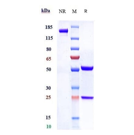 SDS-PAGE - Anti-SLC44A4 Antibody [ASG-5ME] - Low endotoxin, Azide free (A324247) - Antibodies.com