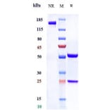 SDS-PAGE - Anti-SLC44A4 Antibody [ASG-5ME] - Low endotoxin, Azide free (A324247) - Antibodies.com