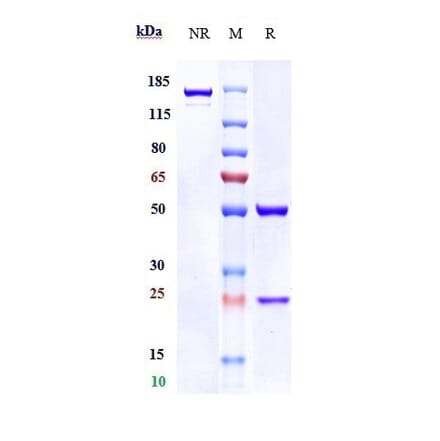 SDS-PAGE - Anti-ST14 Antibody [Research Grade Biosimilar] - Low endotoxin, Azide free (A324248) - Antibodies.com