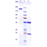 SDS-PAGE - Anti-TGF beta Receptor II Antibody [LY3022859] - Low endotoxin, Azide free (A324258) - Antibodies.com