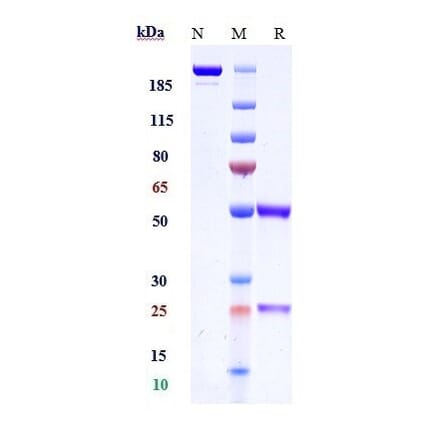 SDS-PAGE - Anti-TIE2 Antibody [Research Grade Biosimilar] - Low endotoxin, Azide free (A324259) - Antibodies.com