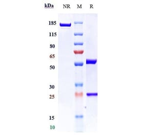 SDS-PAGE - Anti-TLR3 Antibody [CNTO5429] - Low endotoxin, Azide free (A324262) - Antibodies.com