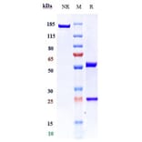 SDS-PAGE - Anti-TLR3 Antibody [CNTO5429] - Low endotoxin, Azide free (A324262) - Antibodies.com