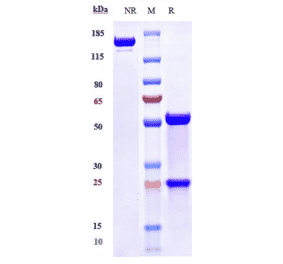SDS-PAGE - Anti-TLR7 Antibody [Research Grade Biosimilar] - Low endotoxin, Azide free (A324263) - Antibodies.com