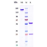 SDS-PAGE - Anti-TMEFF1/Tomoregulin-1 Antibody [Research Grade Biosimilar] - Low endotoxin, Azide free (A324264) - Antibodies.com