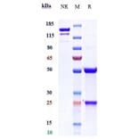 SDS-PAGE - Anti-TMEFF2/Tomoregulin-2 Antibody [Research Grade Biosimilar] - Low endotoxin, Azide free (A324265) - Antibodies.com