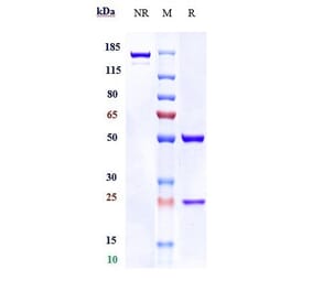 SDS-PAGE - Anti-TMEM16A Antibody [Research Grade Biosimilar] - Low endotoxin, Azide free (A324266) - Antibodies.com