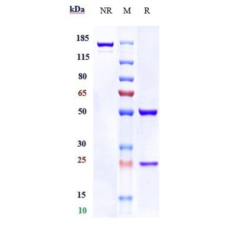 SDS-PAGE - Anti-TMEM16A Antibody [Research Grade Biosimilar] - Low endotoxin, Azide free (A324266) - Antibodies.com