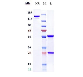 SDS-PAGE - Anti-TMPRSS2 Antibody [Research Grade Biosimilar] - Low endotoxin, Azide free (A324267) - Antibodies.com