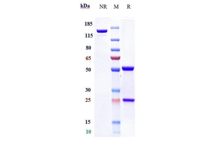 SDS-PAGE - Anti-TMPRSS2 Antibody [Research Grade Biosimilar] - Low endotoxin, Azide free (A324267) - Antibodies.com