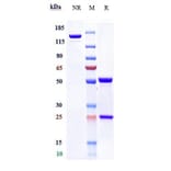 SDS-PAGE - Anti-TMPRSS2 Antibody [Research Grade Biosimilar] - Low endotoxin, Azide free (A324267) - Antibodies.com