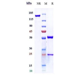 SDS-PAGE - Anti-TNF alpha Antibody [CDP571] - Low endotoxin, Azide free (A324269) - Antibodies.com