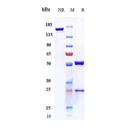 SDS-PAGE - Anti-TNF alpha Antibody [CDP571] - Low endotoxin, Azide free (A324269) - Antibodies.com