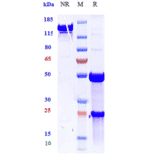 SDS-PAGE - Anti-TNF alpha Antibody [ESBA 105] - Low endotoxin, Azide free (A324270) - Antibodies.com