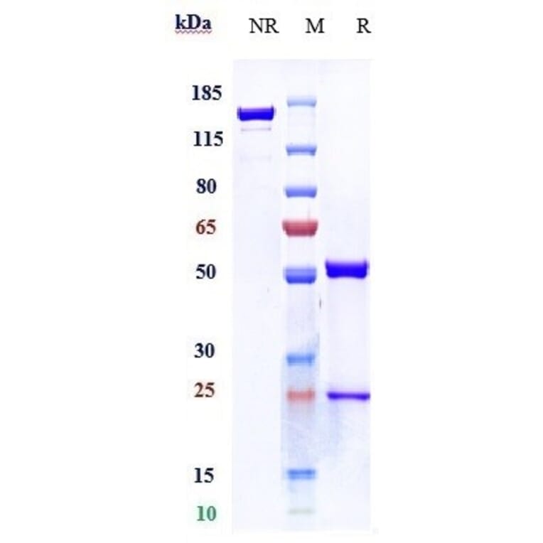 SDS-PAGE - Anti-TNF alpha Antibody [CMAB008] - Low endotoxin, Azide free (A324271) - Antibodies.com