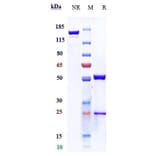 SDS-PAGE - Anti-TNF alpha Antibody [CMAB008] - Low endotoxin, Azide free (A324271) - Antibodies.com