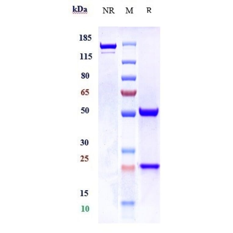 SDS-PAGE - Anti-TPSB2 Antibody [Research Grade Biosimilar] - Low endotoxin, Azide free (A324275) - Antibodies.com