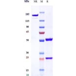 SDS-PAGE - Anti-Transferrin Receptor Antibody [Jr-141] - Low endotoxin, Azide free (A324276) - Antibodies.com