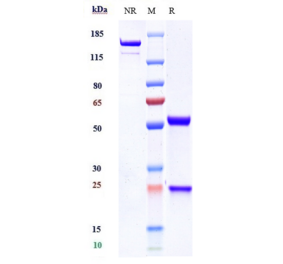 SDS-PAGE - Anti-TREM1 Antibody [PY159] - Low endotoxin, Azide free (A324278) - Antibodies.com