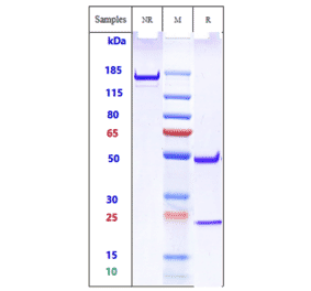 SDS-PAGE - Anti-TREM2 Antibody [PY314] - Low endotoxin, Azide free (A324279) - Antibodies.com