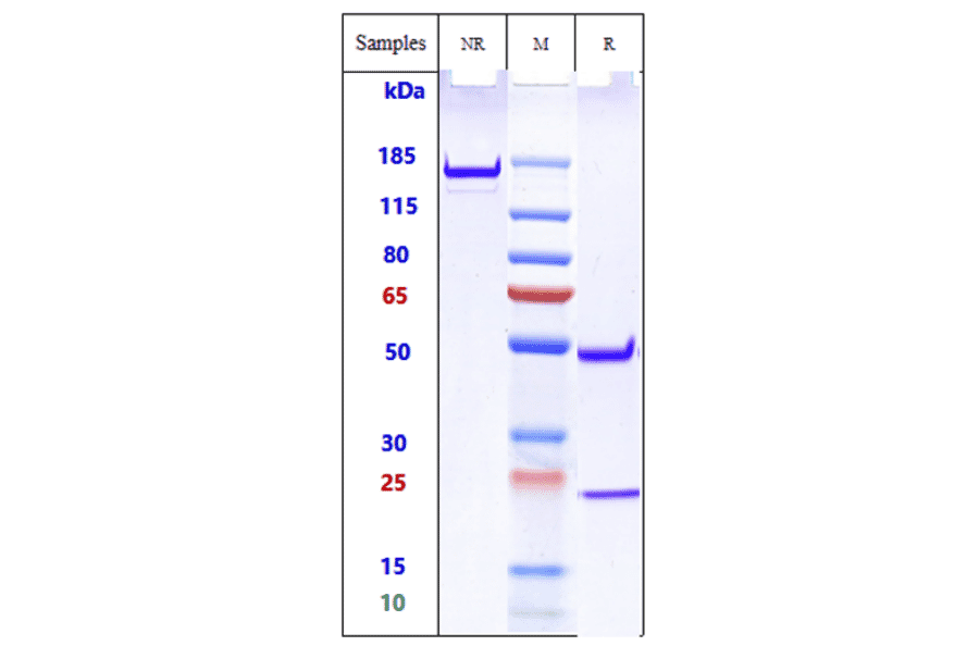 SDS-PAGE - Anti-TREM2 Antibody [PY314] - Low endotoxin, Azide free (A324279) - Antibodies.com