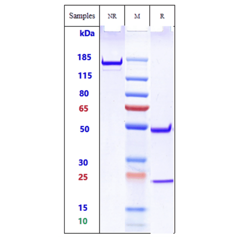 SDS-PAGE - Anti-TREM2 Antibody [PY314] - Low endotoxin, Azide free (A324279) - Antibodies.com