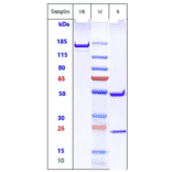 SDS-PAGE - Anti-TREM2 Antibody [PY314] - Low endotoxin, Azide free (A324279) - Antibodies.com