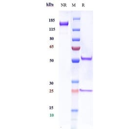 SDS-PAGE - Anti-TrkB Antibody [Research Grade Biosimilar] - Low endotoxin, Azide free (A324281) - Antibodies.com