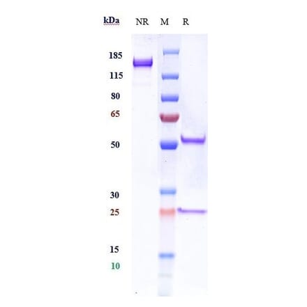 SDS-PAGE - Anti-TrkB Antibody [Research Grade Biosimilar] - Low endotoxin, Azide free (A324281) - Antibodies.com
