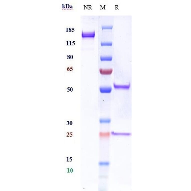 SDS-PAGE - Anti-TrkB Antibody [Research Grade Biosimilar] - Low endotoxin, Azide free (A324281) - Antibodies.com
