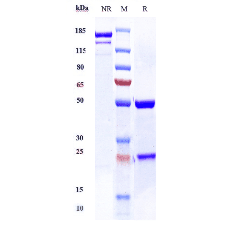 SDS-PAGE - Anti-TSH Receptor/TSH-R Antibody [K1-70] - Low endotoxin, Azide free (A324282) - Antibodies.com