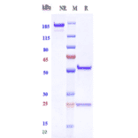 SDS-PAGE - Anti-Tspan-8 Antibody [Research Grade Biosimilar] - Low endotoxin, Azide free (A324284) - Antibodies.com