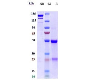 SDS-PAGE - Anti-TYRO3 Antibody [ELB031] - Low endotoxin, Azide free (A324286) - Antibodies.com
